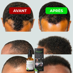 Charger l'image dans la galerie, Huile Naturelle Booster Cheveux &amp; Barbe (Spécial Hommes)
