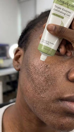 Charger l'image dans la galerie, GEL EXFOLIANT CORACODE
